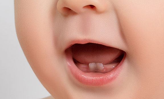 الحفاظ على أسنان طفلك الرضيع يبدأ مبكرا