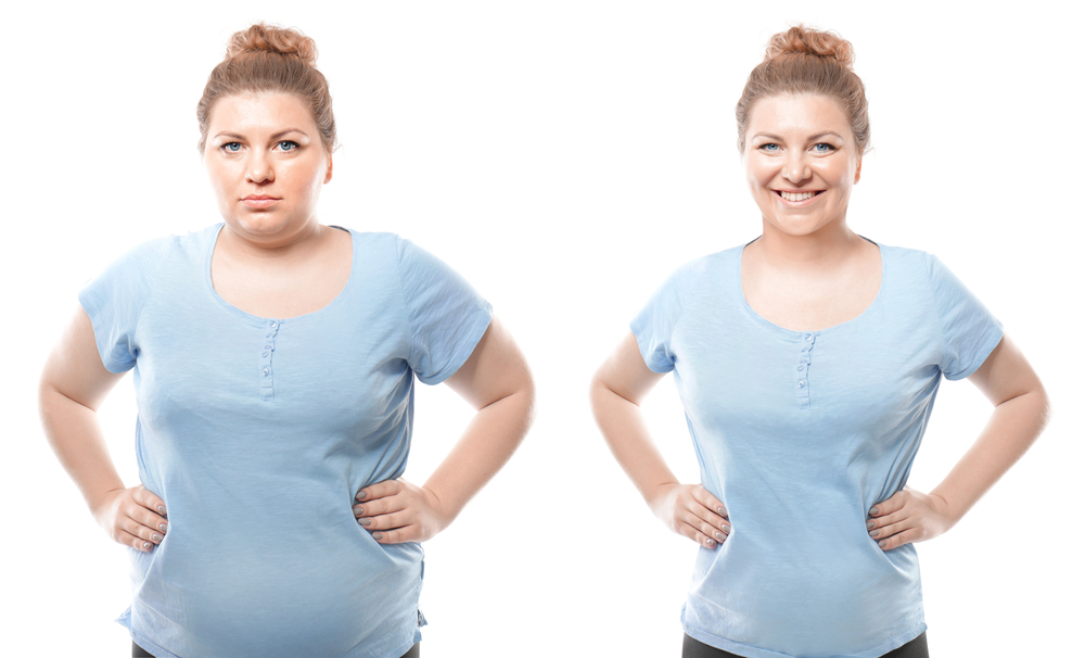 الفرق بين عملية شفط الدهون جراحياً و بالليزر